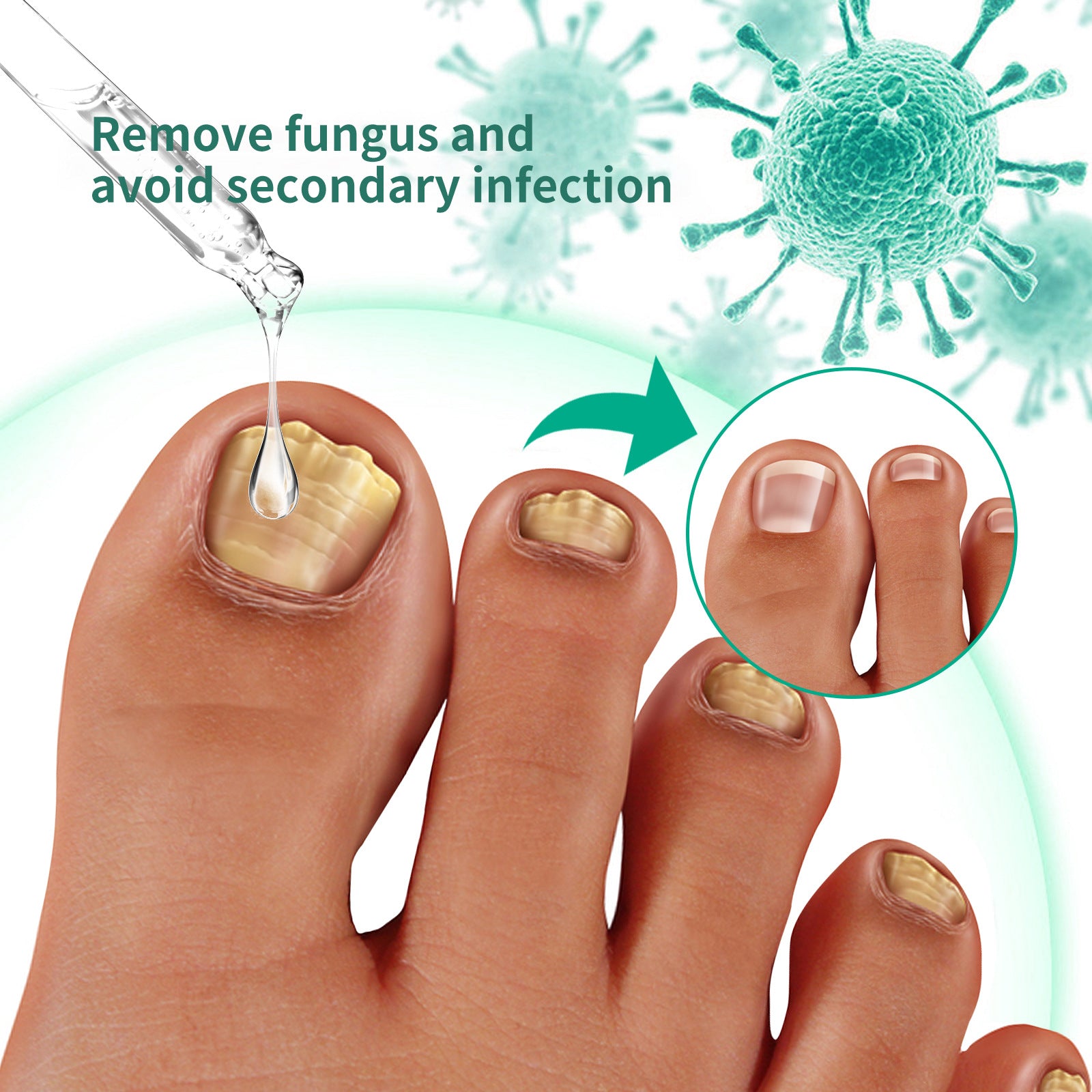 Repair Raw Nail Rotten Toenail Bad Gentle Get Rid Of Gray